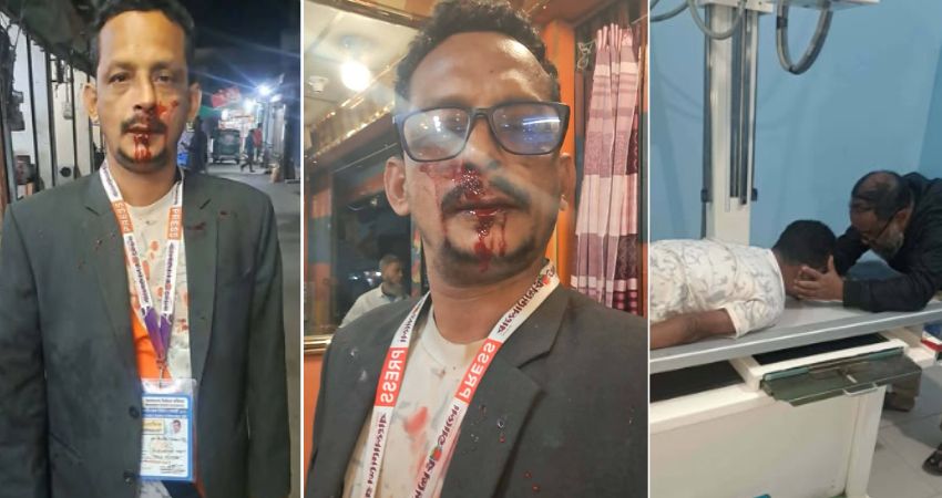 বাংলাদেশের ভোটের কারচুপি’র ছবি তুলতে গিয়ে আহত সাংবাদিক