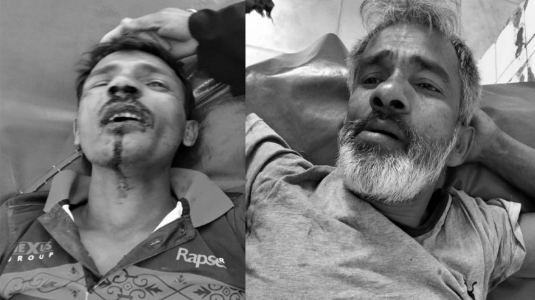 যশোরে যুবলীগ নেতা বাবুকে হত্যার উদ্দেশ্যে নৃশংস হামলা