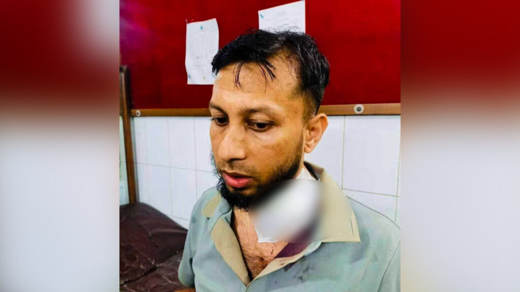 বিদ্যুৎ না থাকায় বাইরে বসা এসিল্যান্ডকে কুপিয়ে জখম, ২ লাখ ৭০ হাজার টাকা ও প্রায় ১৪ ভরি স্বর্ণালংকার লুট